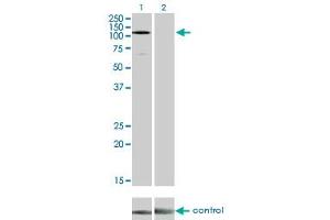 Western blot analysis of EPHA3 over-expressed 293 cell line, cotransfected with EPHA3 Validated Chimera RNAi (Lane 2) or non-transfected control (Lane 1). (EPH Receptor A3 抗体  (AA 202-326))