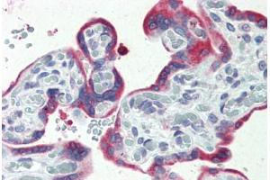 Human, Placenta: Formalin-Fixed Paraffin-Embedded (FFPE) (ERP44 抗体  (C-Term))