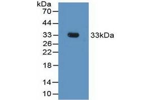 Detection of Recombinant FCN1, Rat using Polyclonal Antibody to Ficolin 1 (FCN1) (FCN1 抗体  (AA 25-279))