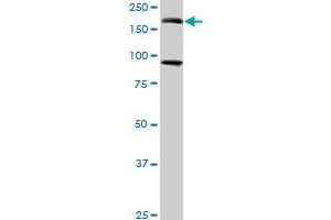 Western Blotting (WB) image for anti-Eukaryotic Translation Initiation Factor 4 gamma 3 (EIF4G3) (AA 1-516) antibody (ABIN599055) (EIF4G3 抗体  (AA 1-516))
