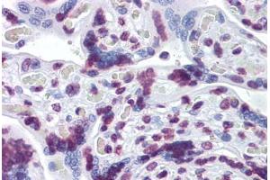 Human Placenta: Formalin-Fixed, Paraffin-Embedded (FFPE) (RBM5 抗体  (AA 75-184))