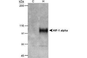 Image no. 3 for anti-Hypoxia Inducible Factor 1, alpha Subunit (Basic Helix-Loop-Helix Transcription Factor) (HIF1A) (AA 432-528) antibody (ABIN2852421)