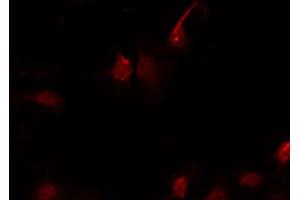 ABIN6267641 staining Hela by IF/ICC. (eIF4EBP1 抗体  (pThr45))