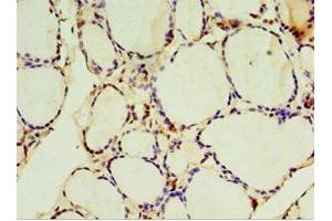 Immunohistochemistry of paraffin-embedded human thyroid tissue using ABIN7170959 at dilution of 1:100 (SULT1C2 抗体  (AA 1-120))