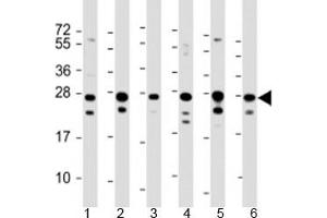 Western blot testing of human 1) HeLa, 2) HepG2, 3) Jurkat, 4) Raji, 5) 293 and 6) 293T/17 cell lysate with PCMT1 antibody at 1:2000. (PCMT1 抗体  (AA 93-126))