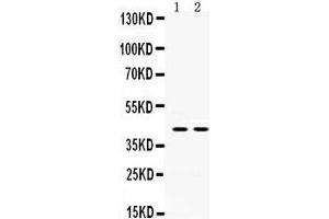 Western Blotting (WB) image for anti-Hydroxysteroid (11-Beta) Dehydrogenase 2 (HSD11B2) (AA 277-309), (C-Term) antibody (ABIN3043846) (HSD11B2 抗体  (C-Term))