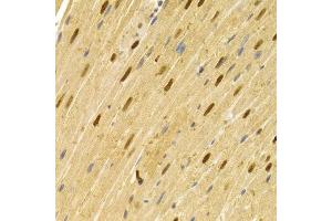 Immunohistochemistry of paraffin-embedded rat heart using CDC25A antibody (ABIN5970519) at dilution of 1/100 (40x lens). (CDC25A 抗体)