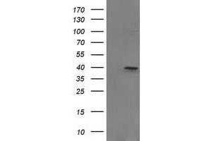 Image no. 1 for anti-PIH1 Domain Containing 2 (PIH1D2) antibody (ABIN1500197) (PIH1D2 抗体)