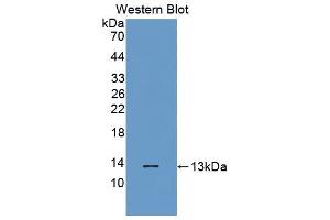 Western blot analysis of the recombinant protein. (Melatonin Receptor 1A 抗体  (AA 296-350))