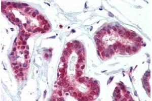 Human Breast (formalin-fixed, paraffin-embedded) stained with PRMT1 antibody ABIN462306 followed by biotinylated goat anti-rabbit IgG secondary antibody ABIN481713, alkaline phosphatase-streptavidin and chromogen. (PRMT1 抗体  (AA 317-346))