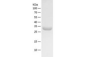 MAK16 Homolog (MAK16) (AA 1-300) protein (His-IF2DI Tag)
