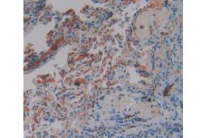 IHC-P analysis of Human Lung Tissue, with DAB staining. (FGG 抗体  (AA 166-416))