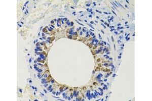 Immunohistochemistry of paraffin-embedded Mouse lung using CALB2 Polyclonal Antibody at dilution of 1:100 (40x lens). (Calretinin 抗体)