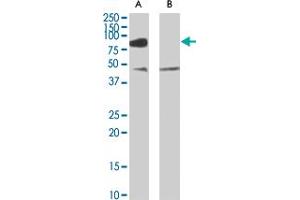 ZDHHC8 polyclonal antibody  (0. (ZDHHC8 抗体)