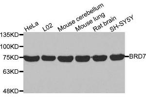 Western blot analysis of extracts of various cell lines, using BRD7 antibody. (BRD7 抗体  (AA 1-95))