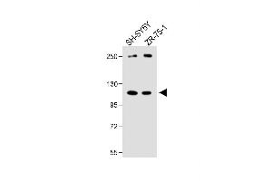 All lanes : Anti-PCDHA8 Antibody (C-term) at 1:1000 dilution Lane 1: SH-SY5Y whole cell lysate Lane 2: ZR-75-1 whole cell lysate Lysates/proteins at 20 μg per lane. (PCDHa8 抗体  (C-Term))