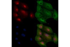 ABIN6257837 and ABIN6275222 staining  cells by IF/ICC. (MED8 抗体  (C-Term))