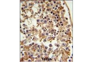 Immunohistochemistry (Paraffin-embedded Sections) (IHC (p)) image for anti-Fanconi Anemia, Complementation Group C (FANCC) (AA 527-555), (C-Term) antibody (ABIN653475)