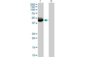 Western Blot analysis of NOV expression in transfected 293T cell line by NOV MaxPab polyclonal antibody. (NOV 抗体  (AA 1-357))