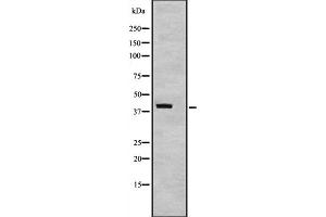 Western blot analysis of TAF7 expression in TAF7 transfected 293T cell lysate,The lane on the left is treated with the antigen-specific peptide. (TAF7 抗体  (Internal Region))