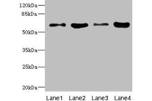 Western blot All lanes: PIP5K1A antibody at 4. (PIP5K1A 抗体  (AA 293-562))