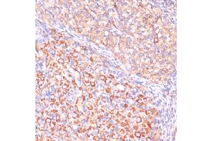 Immunohistochemistry (IHC) image for anti-Von Hippel-Lindau Tumor Suppressor, E3 Ubiquitin Protein Ligase (VHL) (AA 1-172) antibody (ABIN3020968)