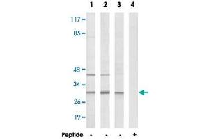 Western blot analysis of extracts from COLO cells (Lane 1), HeLa cells (Lane 2) and HUVEC cells (Lane 3 and lane 4), using RPS4Y1 polyclonal antibody . (RPS4Y1 抗体  (C-Term))