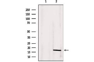 Western blot analysis of extracts from 293, using ANG Antibody. (ANG 抗体  (Internal Region))