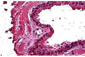 Human Prostate, Epithelium: Formalin-Fixed, Paraffin-Embedded (FFPE) (ERN1 抗体  (AA 401-500))