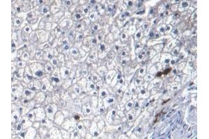 Detection of S100A8 in Human Liver Tissue using Monoclonal Antibody to S100 Calcium Binding Protein A8 (S100A8) (S100A8 抗体  (AA 1-93))