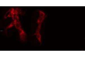 ABIN6272312 staining 293 cells by IF/ICC. (GRAP 抗体)