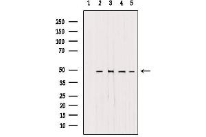 Western Blotting (WB) image for anti-Adaptor-Related Protein Complex 1, mu 1 Subunit (AP1M1) (Internal Region) antibody (ABIN6259962)