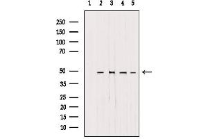 Western blot analysis of extracts from various samples, using AP1M1 antibody. (AP1M1 抗体  (Internal Region))