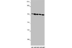 Western blot All lanes: MINPP1 antibody at 14 μg/mL Lane 1: Jurkat whole cell lysate Lane 2: U251 whole cell lysate Lane 3: K562 whole cell lysate Lane 4: Hela whole cell lysate Lane 5: HepG2 whole cell lysate Secondary Goat polyclonal to rabbit IgG at 1/10000 dilution Predicted band size: 56, 35, 32, 34 kDa Observed band size: 56 kDa (MINPP1 抗体  (AA 31-487))