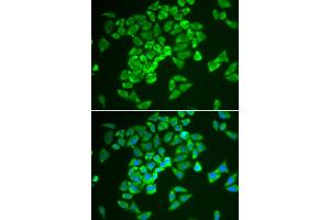 Immunofluorescence analysis of A549 cells using KEAP1 antibody. (KEAP1 抗体)