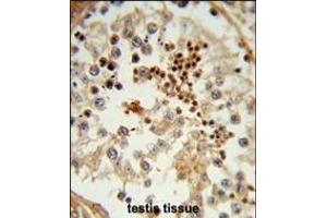 Formalin-fixed and paraffin-embedded human testis tissue reacted with HSL Antibody (C-term), which was peroxidase-conjugated to the secondary antibody, followed by DAB staining. (HSPA4L 抗体  (C-Term))