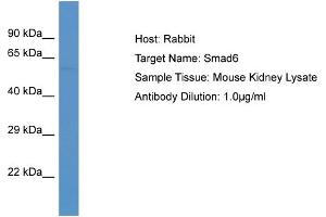 Host: Rabbit Target Name: SMAD6 Sample Tissue: Mouse Kidney Antibody Dilution: 1ug/ml (SMAD6 抗体  (C-Term))