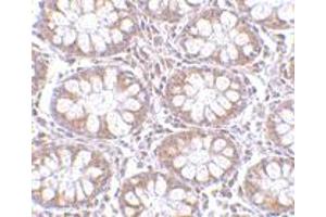 Immunohistochemistry of CD248 in human colon tissue with CD248 polyclonal antibody  at 2. (CD248 抗体  (C-Term))