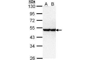 WB Image Sample (30 ug of whole cell lysate) A: Hela B: Hep G2 , 10% SDS PAGE antibody diluted at 1:1000 (STK40 抗体)