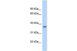 WB Suggested Anti-GAPDH Antibody Titration: 0. (GAPDH 抗体  (Middle Region))