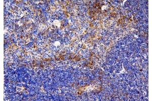 IHC analysis of CCR6 using anti-CCR6 antibody (ABIN7603110). (CCR6 抗体  (N-Term))