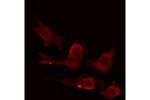 ABIN6275224 staining HuvEc cells by IF/ICC. (MIA2 抗体  (C-Term))