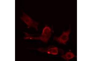 ABIN6275224 staining HuvEc cells by IF/ICC.