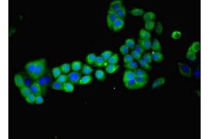 Immunofluorescent analysis of PC-3 cells using ABIN7159273 at dilution of 1:100 and Alexa Fluor 488-congugated AffiniPure Goat Anti-Rabbit IgG(H+L) (MAGEA8 抗体  (AA 1-270))