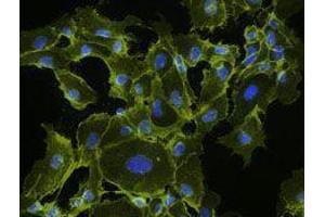 Immunofluorescence (IF) image for anti-Cadherin 5 (CDH5) antibody (ABIN2664233) (Cadherin 5 抗体)