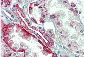 Kidney, Human: Formalin-Fixed, Paraffin-Embedded (FFPE) (Cytokeratin 18 抗体)