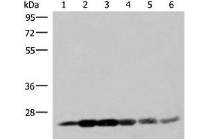 Western blot analysis of 293T cell lysates using GSTK1 Polyclonal Antibody at dilution of 1:250 (GSTK1 抗体)