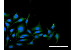 Immunofluorescence of purified MaxPab antibody to PPP1R2 on HeLa cell. (PPP1R2 抗体  (AA 1-205))