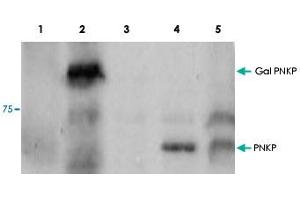 Western blot using PNKP polyclonal antibody  shows detection of a 57 kDa band corresponding to : Lane 1, human PNKP in a Y190 yeast cell lysate.