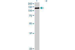 Western Blot analysis of CDH3 expression in transfected 293T cell line by CDH3 MaxPab polyclonal antibody. (P-Cadherin 抗体  (AA 1-829))